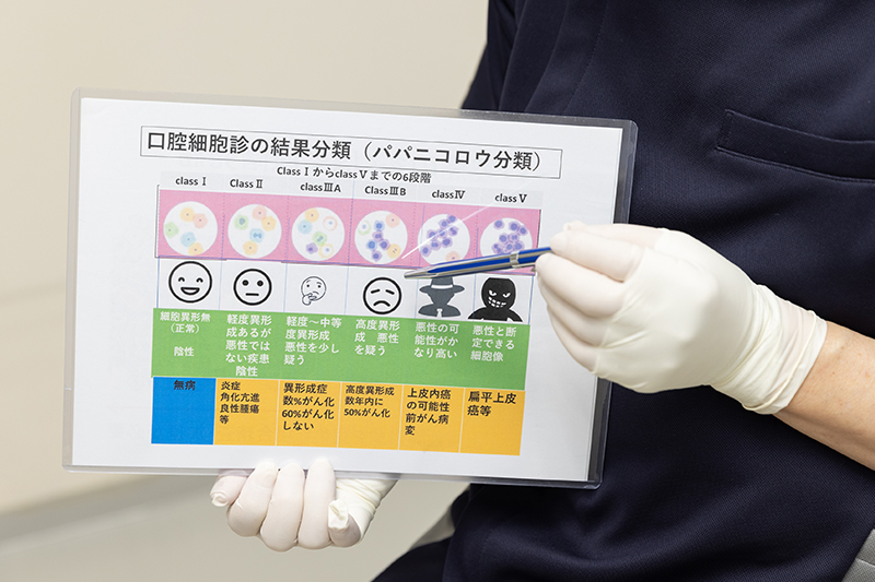 口腔がんの早期発見が診療の基軸