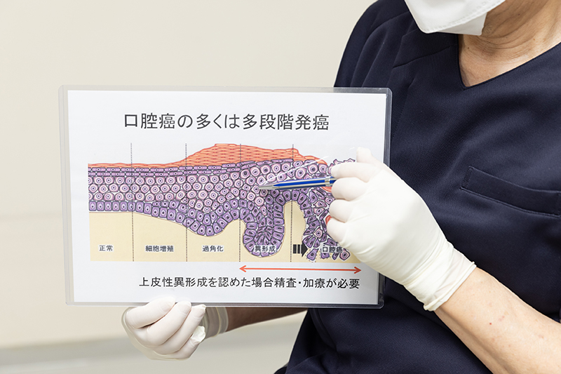 口腔がんの早期発見が診療の基軸